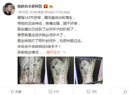 阿哲欲动手术,打针坚持播到年