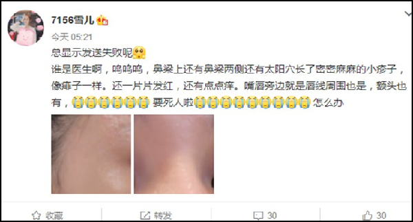 雪儿用错护肤品,皮肤严重过敏